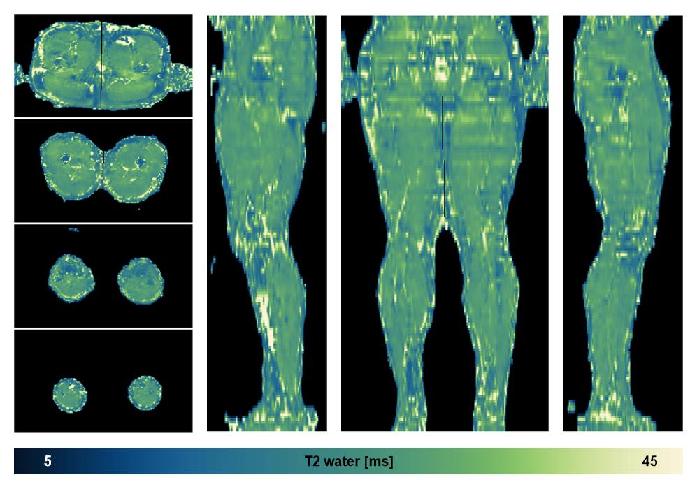 The water only T2 relaxation time of the lower extremity obtained from multi echo spin echo t2 mapping with EPG based reconstruction.